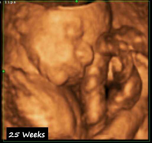 4D Ultrasound in Tulare