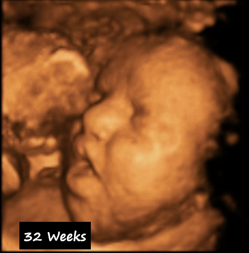 3D Ultrasound services in Tulare